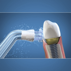 Waterpik Plaque Seeker Tip hambavahepuhastaja vahetusotsik (PS-100E) – Kuva 3